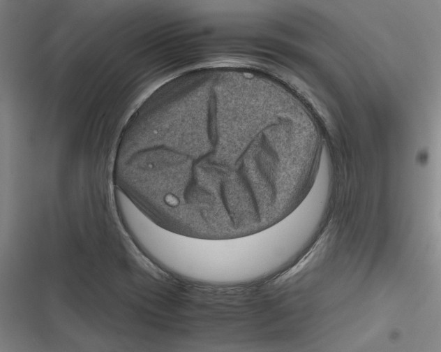 X0000116761417201001141420