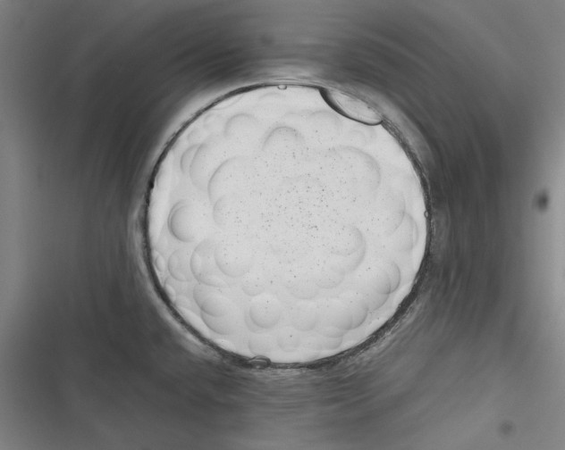 X0000116761432201001141420