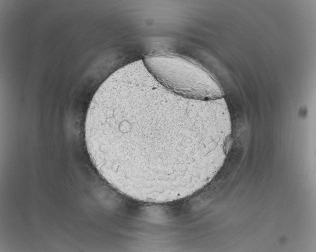 X0000116760417201001281616