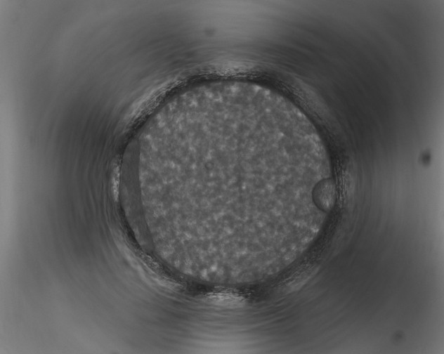 X0000116770644201001071217