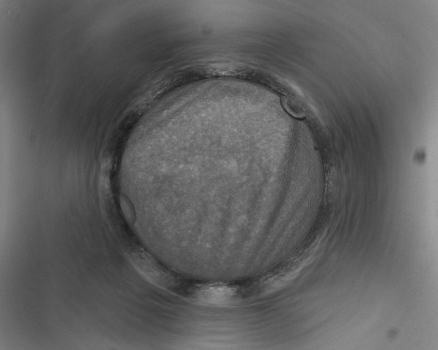 X0000116770217201001141457