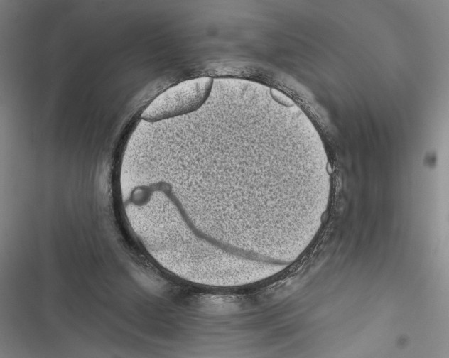X0000116770250201001141456