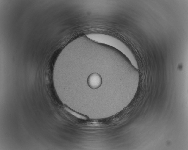 X0000116770316201001141456
