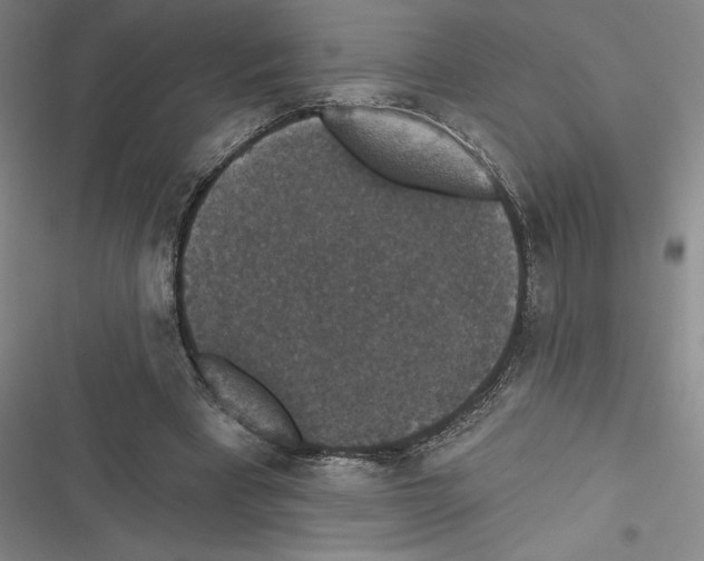 X0000116770393201001141455