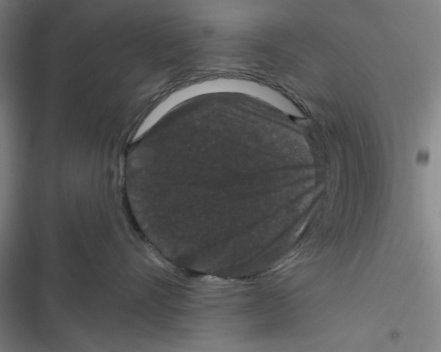 X0000116770528201001141453