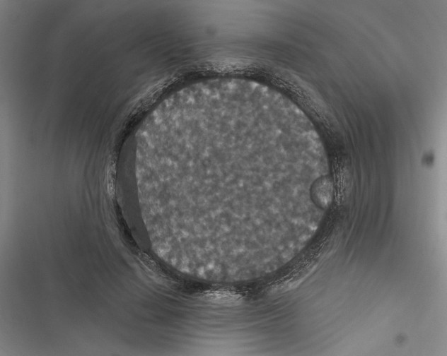 X0000116770644201001141451