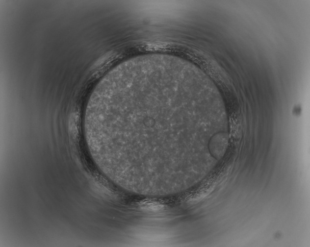 X0000116770648201001141451