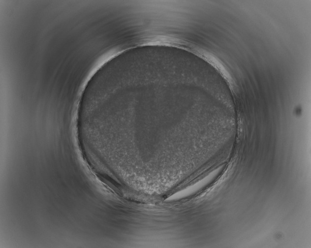 X0000116771138201001141445