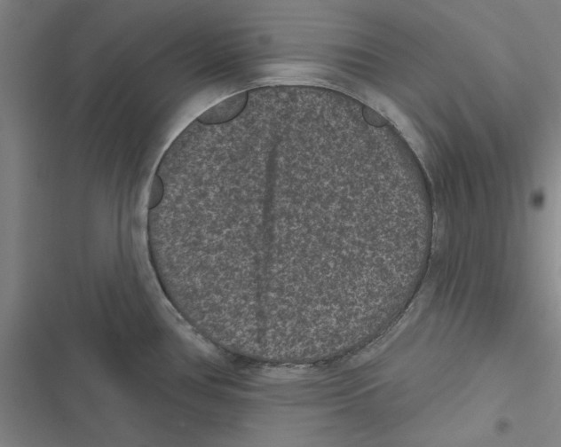X0000116771386201001141441