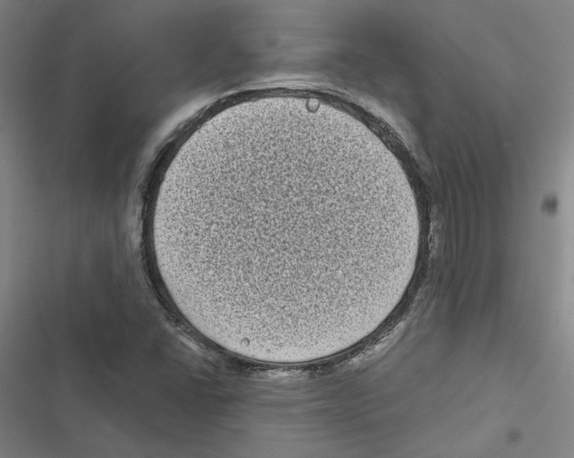 X0000116771406201001141441