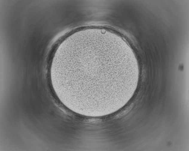 X0000116771406201001281623