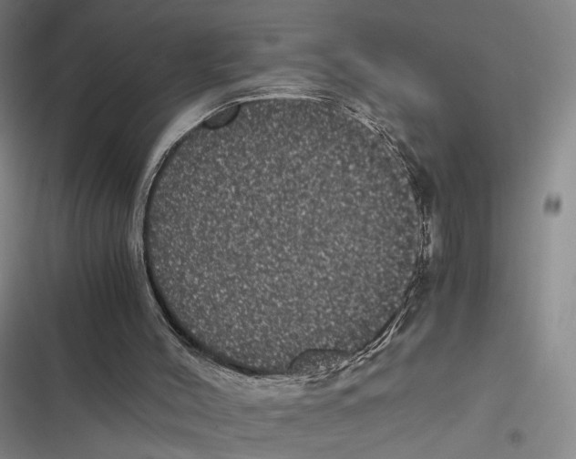 X0000116780004201001141521