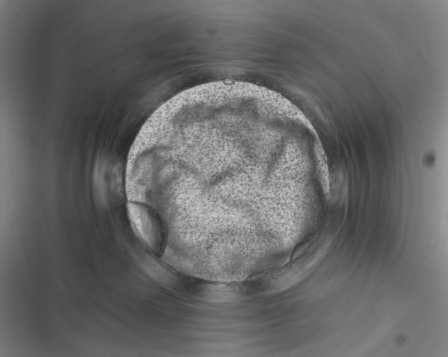 X0000116780238201001141518