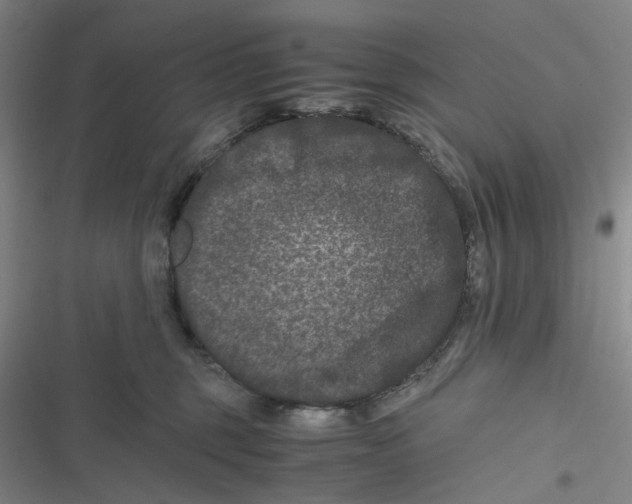 X0000116780375201001141516