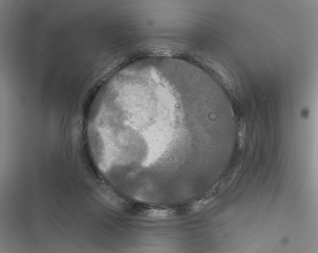 X0000116790314201001151107