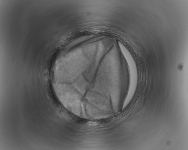 X0000116790704201001151102