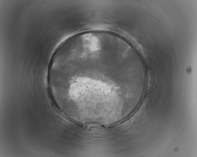 X0000116791174201001151055