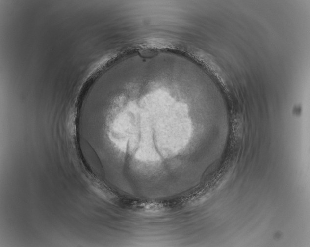 X0000116800395201001151127