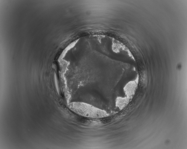 X0000116800715201001151122