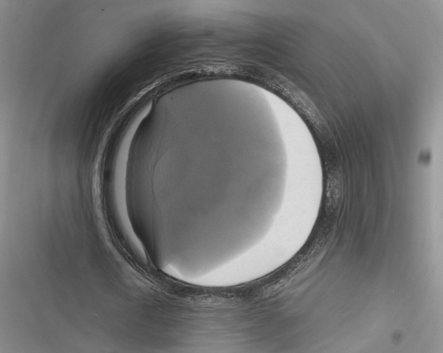 X0000116800722201001151122