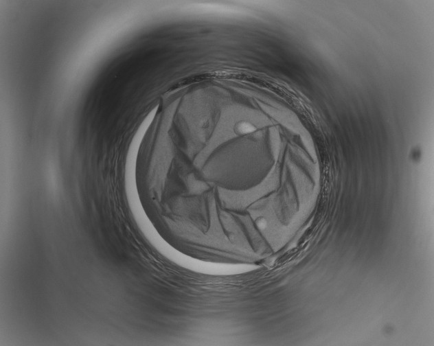 X0000116800762201001151122