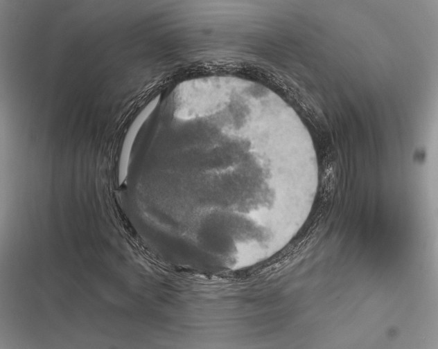 X0000116800772201001151122
