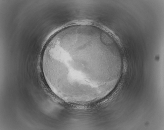 X0000116801174201001291534