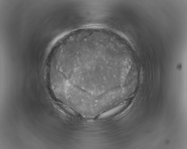 X0000116801406201001291530
