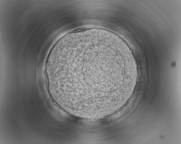 X0000116810856201001151142