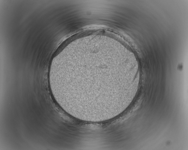 X0000116810937201001151141