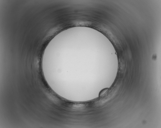 X0000116820357201001081421