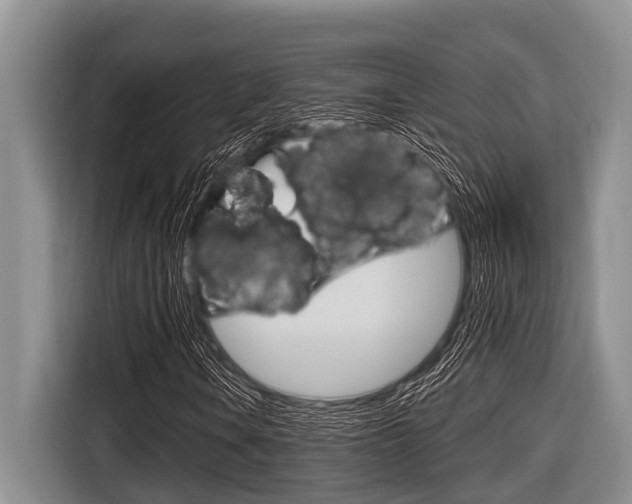 X0000116831106200912181048