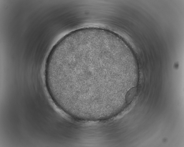 X0000116831038201001081433