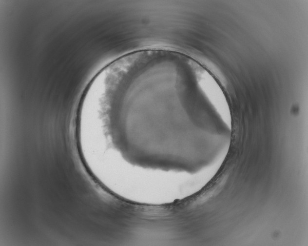 X0000116831007201001151222