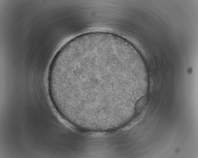 X0000116831038201001151222