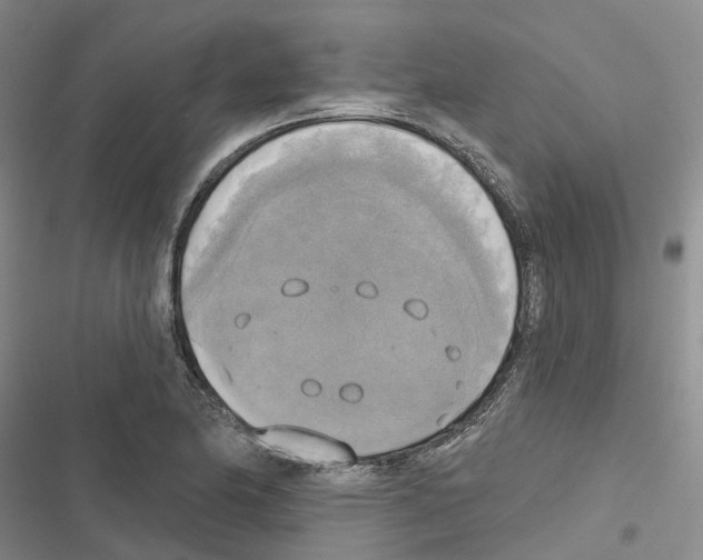 X0000116831174201001151220