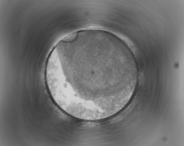 X0000116831374201001151217