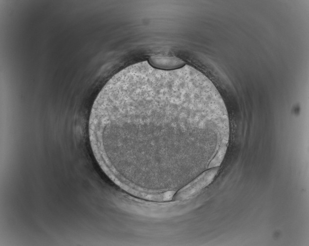 X0000116840035201001151256