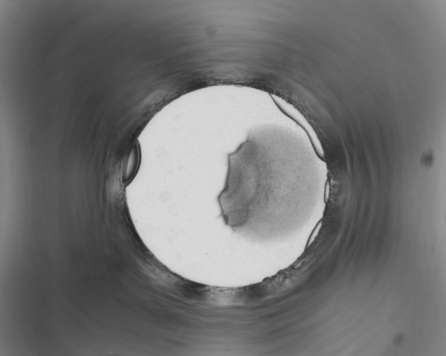 X0000116840143201001151255