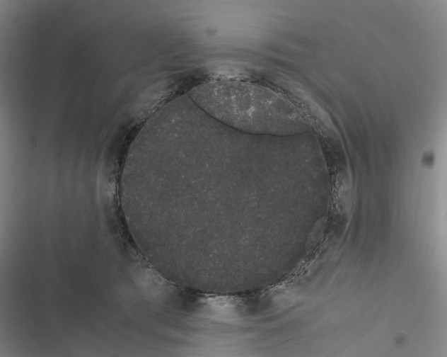 X0000116840417201001151251