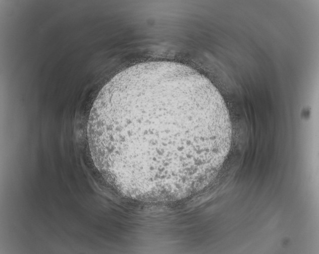 X0000116841154201001151241