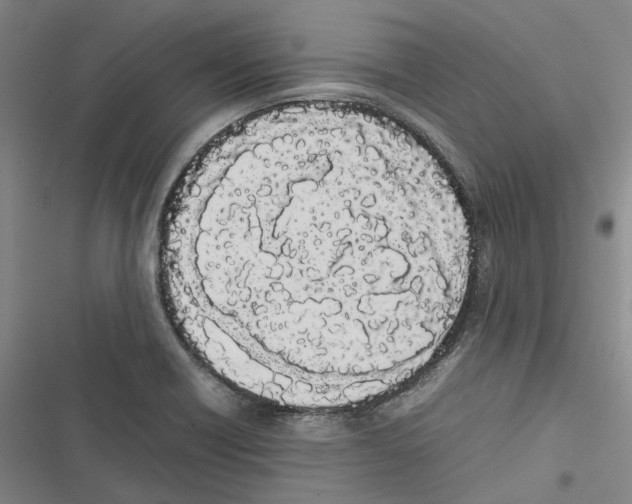 X0000116841418201001151238