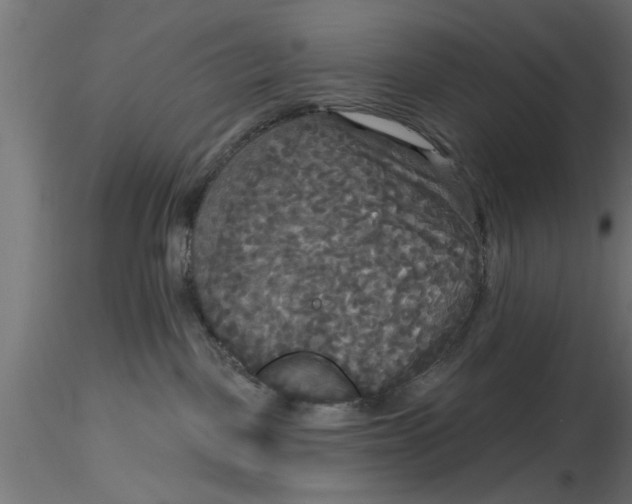 X0000116850093201001051515