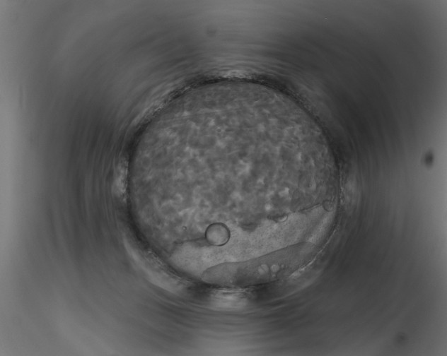 X0000116850175201001051514