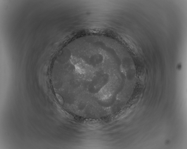 X0000116850817201001121218