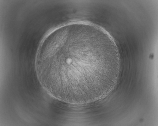X0000116851215201002021038