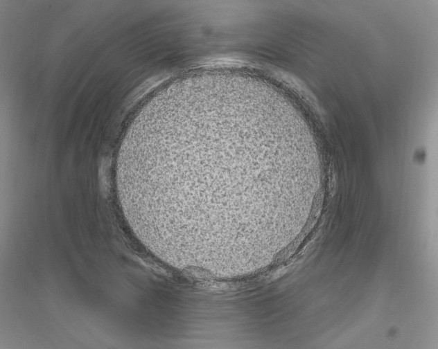 X0000116851217201002021038