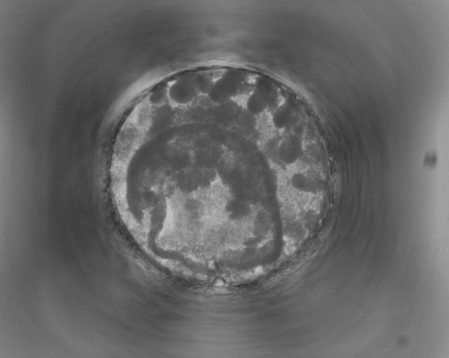 X0000116851359201002021036
