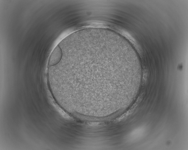 X0000116851378201002021036