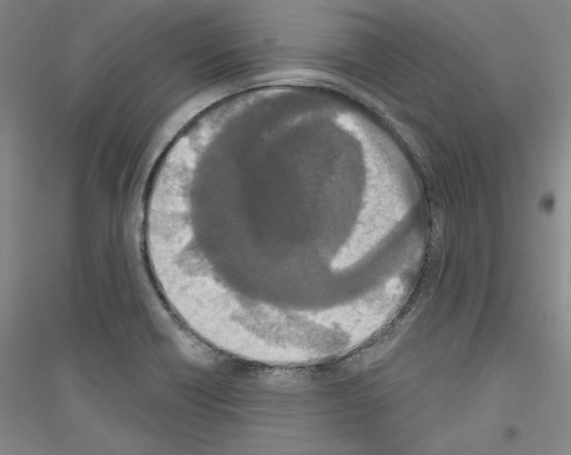 X0000116851418201002021036
